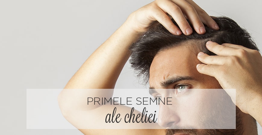 Primele semne ale cheliei