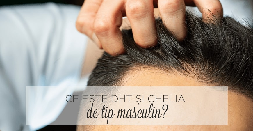 Ce este DHT și chelie de model masculin?