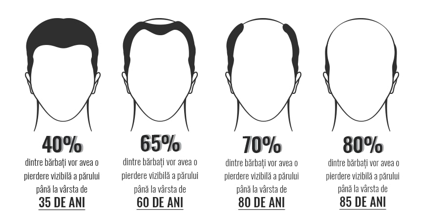 Căderea părului la bărbați Căderea părului la bărbați
