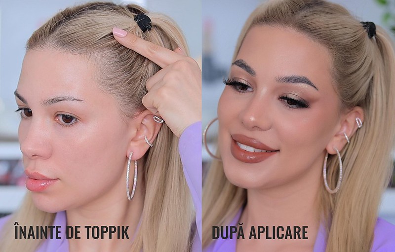 rezultate înainte și după Toppik rezultate înainte și după Toppik